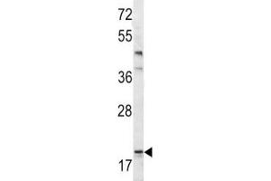 Image no. 3 for anti-BCL2-Associated Agonist of Cell Death (BAD) (AA 92-127) antibody (ABIN3030135)