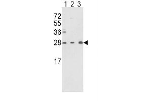 Image no. 1 for anti-Triosephosphate Isomerase 1 (TPI1) antibody (ABIN3001712)