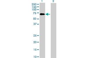 Image no. 1 for anti-Interleukin 13 Receptor, alpha 1 (IL13RA1) (AA 1-427) antibody (ABIN517118)