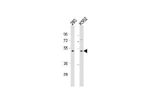 Image no. 5 for anti-Transforming Growth Factor, beta 2 (TGFB2) antibody (ABIN659106)