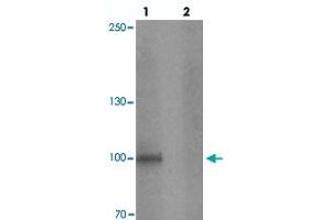 anti-Storkhead Box 1 (STOX1) antibody