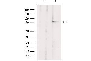 Image no. 3 for anti-ATP-Binding Cassette, Sub-Family B (MDR/TAP), Member 10 (ABCB10) antibody (ABIN6257917)