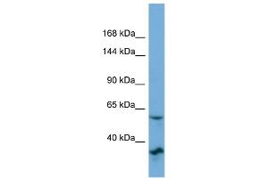 Image no. 1 for anti-Oxysterol Binding Protein 2 (OSBP2) (N-Term) antibody (ABIN2775521)