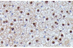 Immunohistochemistry of paraffin-embedded Mouse liver using ID2 Polyclonal Antibody at dilution of 1:100 (40x lens).