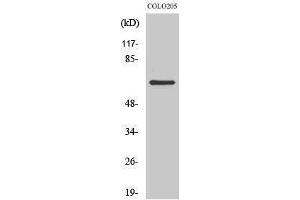 Image no. 1 for anti-Coenzyme Q8A (COQ8A) (Internal Region) antibody (ABIN3183601)