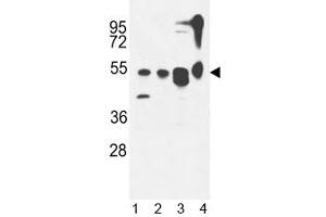 Image no. 3 for anti-Autophagy Related 13 (ATG13) (AA 1-30) antibody (ABIN3030086)