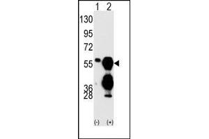 Image no. 1 for anti-Protein Phosphatase 1F (PP2C Domain Containing) (PPM1F) (C-Term) antibody (ABIN360801)