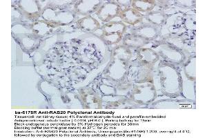 Image no. 2 for anti-RAB20, Member RAS Oncogene Family (RAB20) (AA 131-234) antibody (ABIN2178755)
