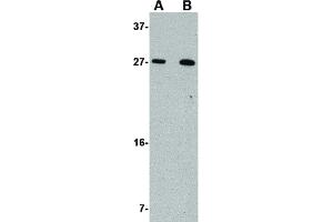 Image no. 1 for anti-Killer Cell Lectin-Like Receptor, Subfamily A, Member 1 (KLRA1) (C-Term) antibody (ABIN6657106)
