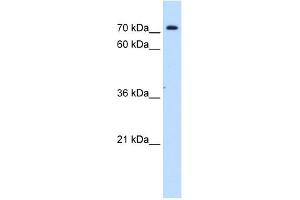 Image no. 1 for anti-Solute Carrier Family 5 (Sodium/inositol Cotransporter), Member 11 (SLC5A11) antibody (ABIN635118)