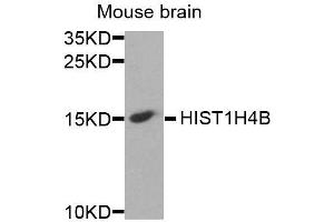 Histone Cluster 1, H4b (HIST1H4B) Antikörper