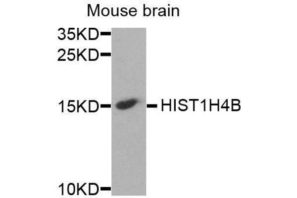 Histone Cluster 1, H4b (HIST1H4B) Antikörper