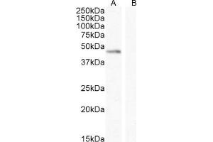 Image no. 2 for anti-Angiopoietin 1 (ANGPT1) (Internal Region) antibody (ABIN768552)