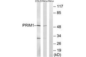 Image no. 1 for anti-Primase, DNA, Polypeptide 1 (49kDa) (PRIM1) (AA 371-420) antibody (ABIN1534842)