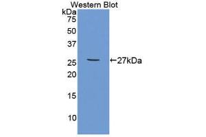 Image no. 1 for anti-Tumor Necrosis Factor Receptor Superfamily, Member 1B (TNFRSF1B) (AA 25-229) antibody (ABIN1871703)