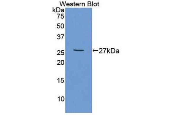 anti-Tumor Necrosis Factor Receptor Superfamily, Member 1B (TNFRSF1B) (AA 25-229) antibody