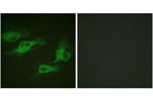 Immunofluorescence analysis of HeLa cells, using Adrenergic Receptor beta2 (Phospho-Ser346) Antibody.