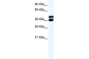 Image no. 3 for anti-Tripartite Motif Containing 13 (TRIM13) (Middle Region) antibody (ABIN2778286)