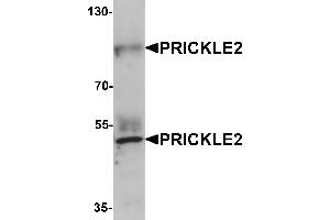 Image no. 1 for anti-Prickle Homolog 2 (PRICKLE2) (Middle Region) antibody (ABIN1031047)
