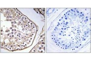 Image no. 1 for anti-B Melanoma Antigen Family, Member 3 (BAGE3) (AA 41-90) antibody (ABIN1534681)