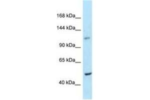 Image no. 1 for anti-diphosphoinositol Pentakisphosphate Kinase 2 (PPIP5K2) (AA 914-963) antibody (ABIN6748048)