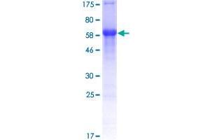 Human Transcription Factor 4 Tcf4 Protein Gst Recombinant Abin