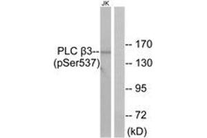 Western blot analysis of extracts from Jurkat cells treated with UV 15', using PLC beta3 (Phospho-Ser537) Antibody.