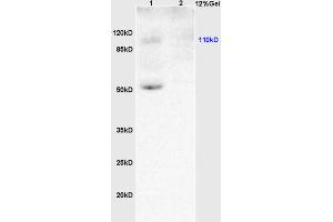 Image no. 3 for anti-Kruppel-Like Factor 5 (Intestinal) (KLF5) (AA 61-160) antibody (ABIN739515)