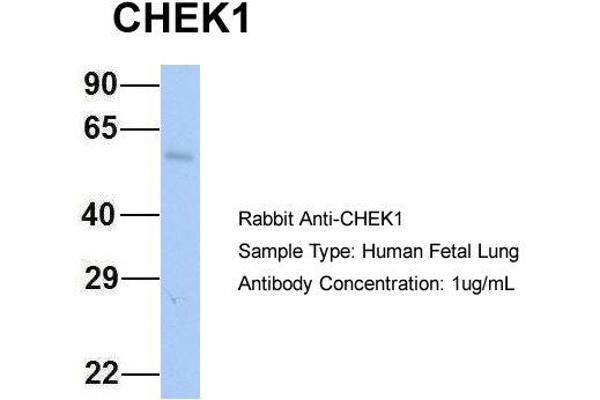anti-Checkpoint Kinase 1 (CHEK1) (Middle Region) antibody
