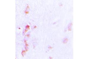Image no. 1 for anti-Cell Division Cycle Associated 3 (CDCA3) (C-Term) antibody (ABIN2704625)