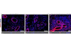 Image no. 2 for anti-Vascular Endothelial Growth Factor C (VEGFC) (AA 321-415) antibody (ABIN731723)