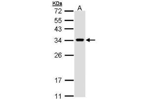 Image no. 3 for anti-VAMP (Vesicle-Associated Membrane Protein)-Associated Protein A, 33kDa (VAPA) (Center) antibody (ABIN2856826)