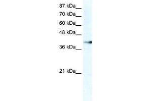Image no. 1 for anti-Zinc Finger Protein 556 (ZNF556) (C-Term) antibody (ABIN2775014)