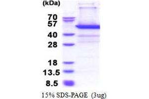 Proteasome (Prosome, Macropain) 26S Subunit, Non-ATPase, 11 (PSMD11) (AA 1-422) protein (His tag)