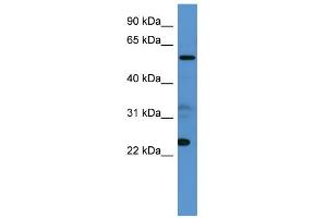 Image no. 1 for anti-Copine IX (CPNE9) (C-Term) antibody (ABIN2785280)