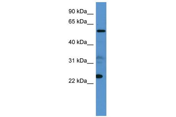 anti-Copine IX (CPNE9) (C-Term) antibody
