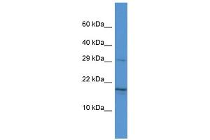 Image no. 1 for anti-Hematological and Neurological Expressed 1 (HN1) (Middle Region) antibody (ABIN2786540)