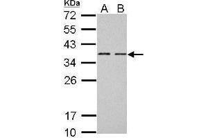 Image no. 3 for anti-B-Cell CLL/lymphoma 7A (BCL7A) (C-Term) antibody (ABIN2854648)