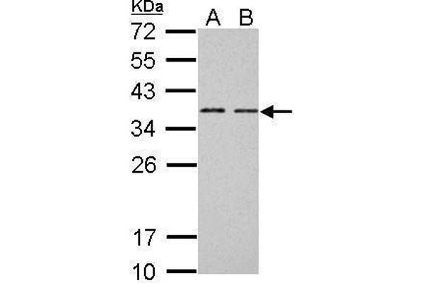 BCL7A Antikörper  (C-Term)
