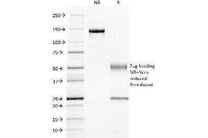 Image no. 1 for anti-Guanine Nucleotide Binding Protein (G Protein), Q Polypeptide (GNAQ) antibody (ABIN6939535)