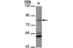 Image no. 1 for anti-Phosphate Regulating Endopeptidase Homolog, X-Linked (PHEX) (Center) antibody (ABIN2856237)