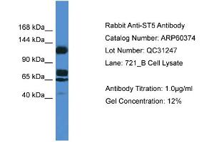 Image no. 1 for anti-Suppression of Tumorigenicity 5 (ST5) (Middle Region) antibody (ABIN2788427)