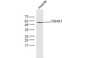 Image no. 2 for anti-Corticotropin Releasing Hormone Receptor 1 (CRHR1) (AA 55-150) antibody (ABIN5675214)