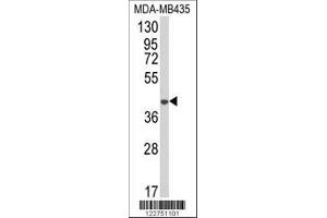 Image no. 1 for anti-1-Acylglycerol-3-Phosphate O-Acyltransferase 4 (AGPAT4) (AA 176-202) antibody (ABIN652650)