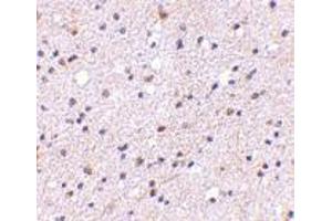 Image no. 1 for anti-Ca++-Dependent Secretion Activator (CADPS) (N-Term) antibody (ABIN499525)