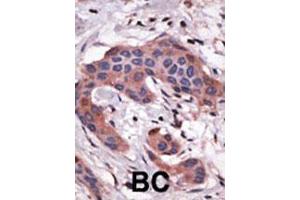 Image no. 3 for anti-BH3 Interacting Domain Death Agonist (BID) (AA 68-103) antibody (ABIN388099)