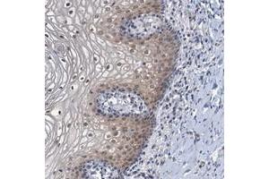POU1F1 antibody