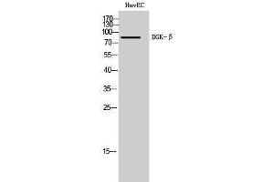 Image no. 1 for anti-Diacylglycerol Kinase, beta 90kDa (DGKB) (C-Term) antibody (ABIN3184292)