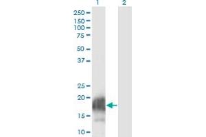 anti-Calcium Regulated Heat Stable Protein 1, 24kDa (CARHSP1) (AA 1-147) antibody