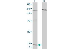 Image no. 3 for anti-Pro-Platelet Basic Protein (Chemokine (C-X-C Motif) Ligand 7) (PPBP) (AA 37-128) antibody (ABIN562336)